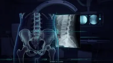 Cyan crosshairs lock a translucent CT volume to a grayscale X-ray under a C-arm for sub-millimeter surgical navigation.